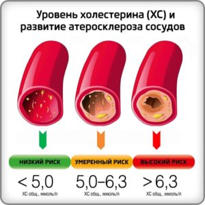 Тромбопол — доступные таблетки для разжижения крови