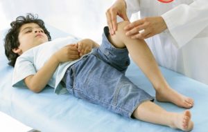 Признаки и лечение дисплазии коленного сустава