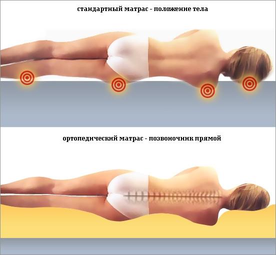 Причины жжения в области спины при остеохондрозе