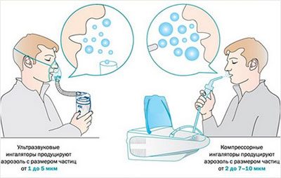 Ультразвуковой небулайзер: эффективный аппарат для лечения кашля и насморка
