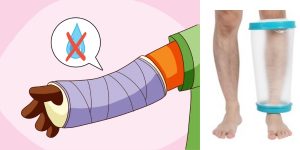 3 вида лечебных ванночек после переломов для рук и ног