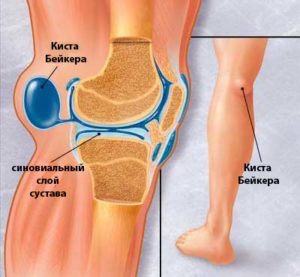 Причины болей в ноге от паха до колена с внутренней и внешней стороны