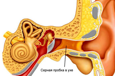 Причины и лечение писка в ушах