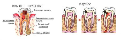 Причины болей в челюсти и способы их устранения