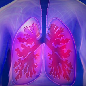 Признаки базального пневмосклероза лёгких: диагностика и лечение