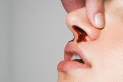 Особенности промывания носа при гайморите
