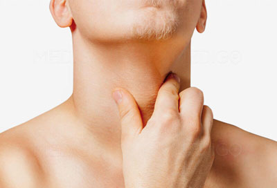 Боль в горле при шейном остеохондрозе