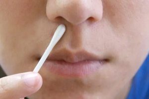 Герпес в носу: чем лечить, фото, симптомы и особенности при беременности