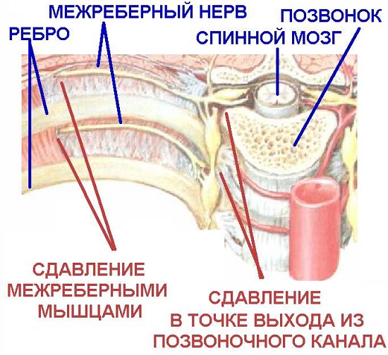 Проявление кашля при грудном и шейном остеохондрозе