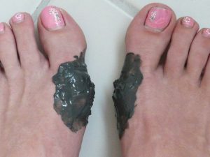 Методы лечения артроза большого и других пальцев ноги