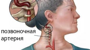 Возникновение болей в шее у ребенка и способы их устранения