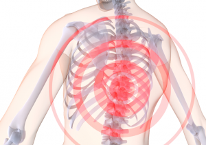 Симптомы и особенности лечения грыжи грудного отдела