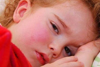 Особенности лечения синдрома Маршала у детей