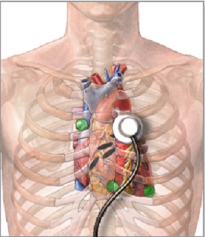 Техника аускультации сердца и ее диагностическое значение