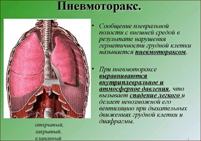 Значение показателей объёма лёгких для диагностики болезней