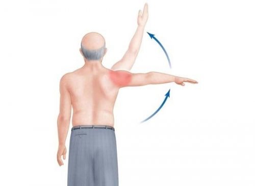 Появление болей в плече при поднятии руки вверх