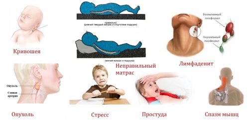 Возникновение болей в шее у ребенка и способы их устранения