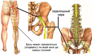 Причины болей в ноге от паха до колена с внутренней и внешней стороны