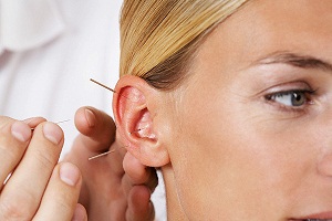С какими патологиями помогает бороться акупунктура уха?