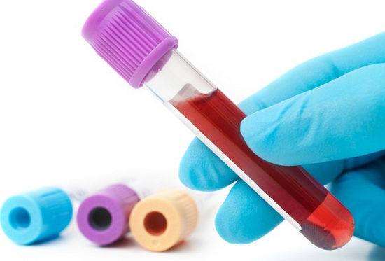 Лабораторная диагностика: общий белок, норма у женщин в анализах мочи и крови