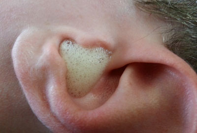 Промывание носа перекисью водорода