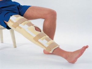 Проявление менисцита коленного сустава и его лечение