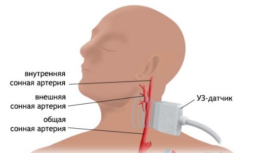 Симптомы стеноза шейного отдела позвоночника и его лечение