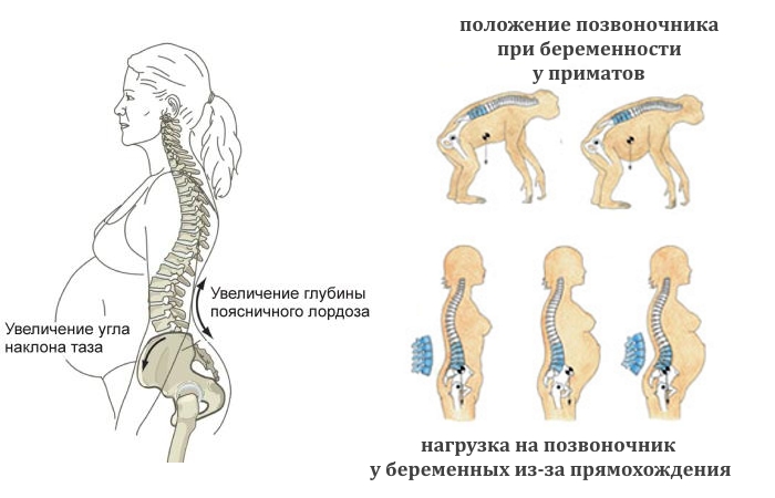 Причины болей в спине после родов и методы их устранения