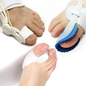Какой врач лечит деформацию в виде косточки на пальце ноги?