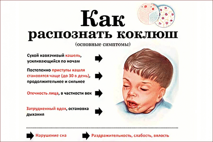 Причины и лечение сильного кашля у ребёнка